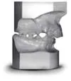 Class 2 malocclusion